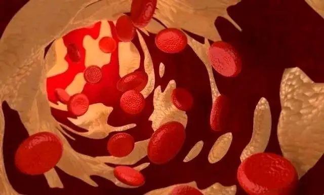 补硒过量导致胆固醇升高(摄入高胆固醇的会长胖吗)-硒宝网