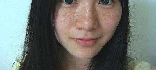 肝硬化腹水怎么补硒好呢(肝硬化腹水营养品)-硒宝网