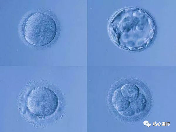 婴儿怎样补硒最好的方法(婴儿补硒吃什么)-硒宝网