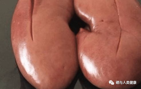 增强免疫补硒吃什么食物(免疫补食物增强吃硒片有用吗)-硒宝网