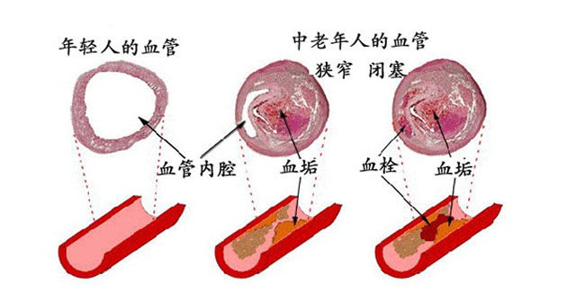 补硒怎么血糖比以前还高(以前血糖补高硒还是低硒)-硒宝网
