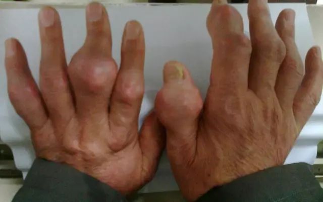 缺钙铁锌硒该怎么补最快(缺钙铁锌硒吃什么药好)-硒宝网