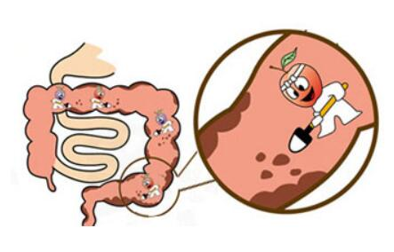 补硒和益生菌的功效区别（益生菌硒多少钱一盒）-硒宝网