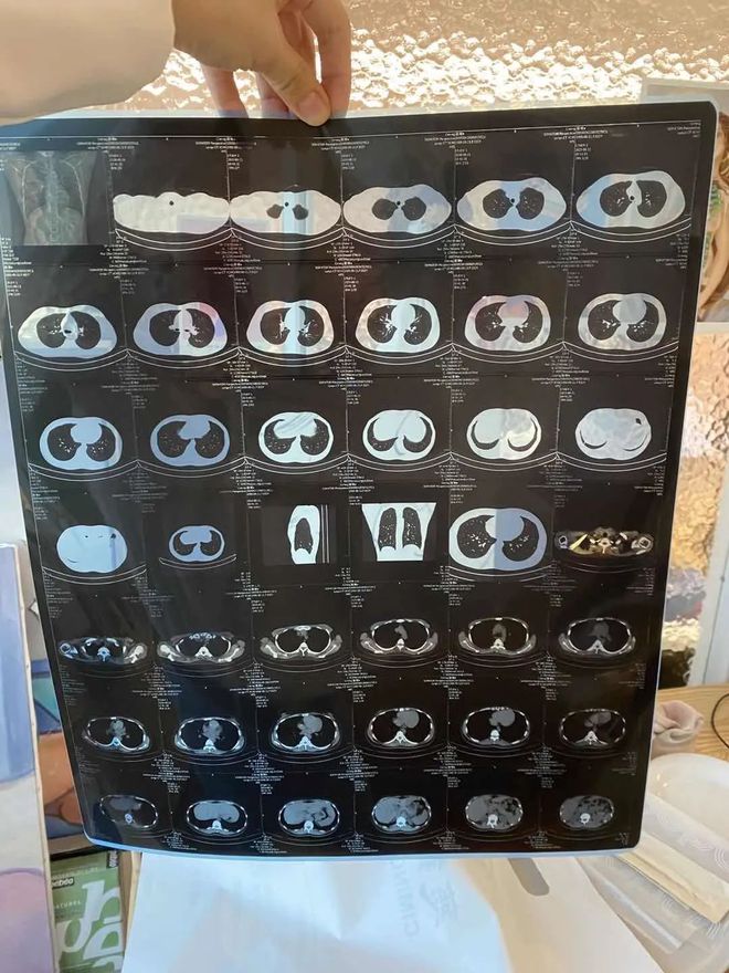 吃啥补硒食物最好吸收钙（补钙补硒）-硒宝网