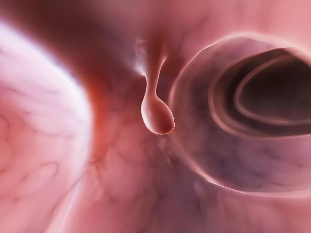 胃息肉手术后可以补硒吗(胃手术补息肉硒可以后用吗)-硒宝网