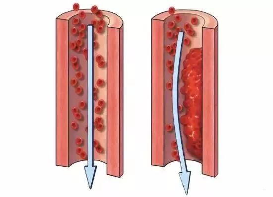 最好的补硒补钙药是什么（补钙补硒食物有哪些）-硒宝网