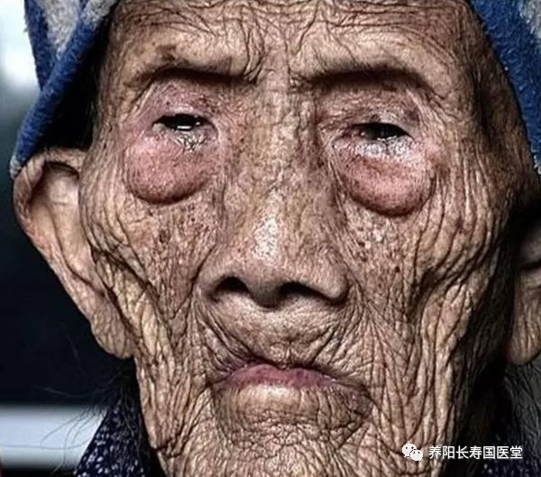 什么东西能有效帮助补硒（补硒能解决身体哪些问题）-硒宝网