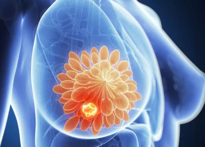 乳腺实性结节可以补硒吗（乳腺结节吃硒片有用吗）-硒宝网