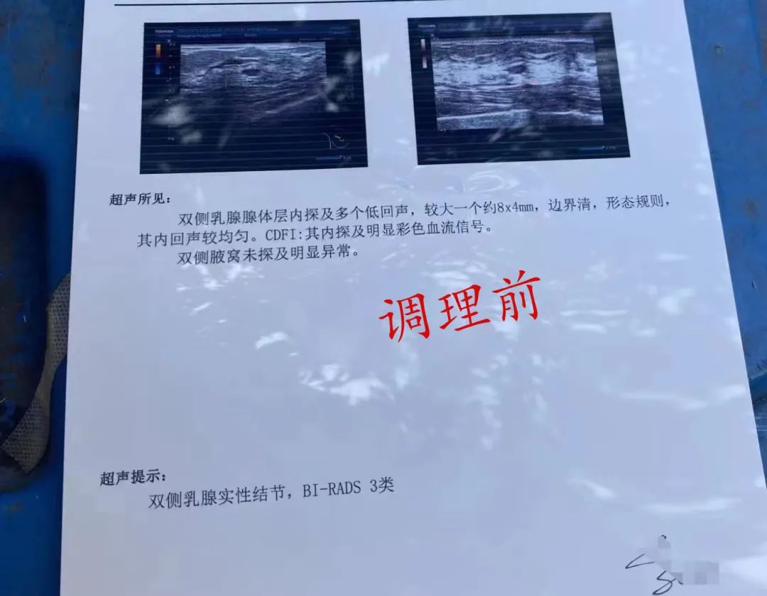 乳腺实性结节可以补硒吗（乳腺结节吃硒片有用吗）-硒宝网