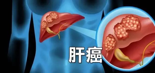 癌症术后患者补硒吃什么（癌症术后补硒有用吗）-硒宝网