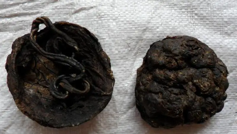 乳腺增生结节补硒有用吗(乳腺结节可以补硒吗补硒元素)-硒宝网