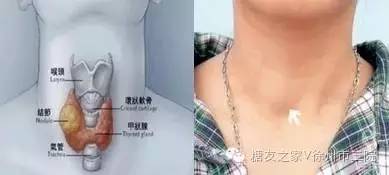 桥本甲状腺炎可以补硒么(桥本甲状腺炎吃硒的作用)-硒宝网