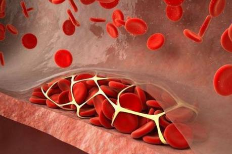 天然硒长期补有副作用吗(天然富硒食品有哪些)-硒宝网