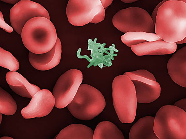 补硒能降甲胎蛋白吗女性(降甲胎蛋白的中草药)-硒宝网