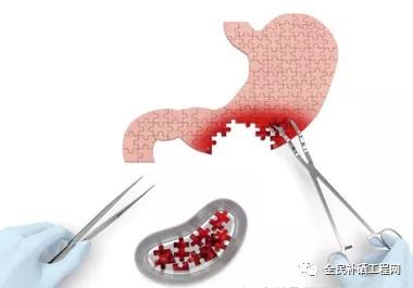 正常的饮食下需要补硒吗（人体需要补硒）-硒宝网