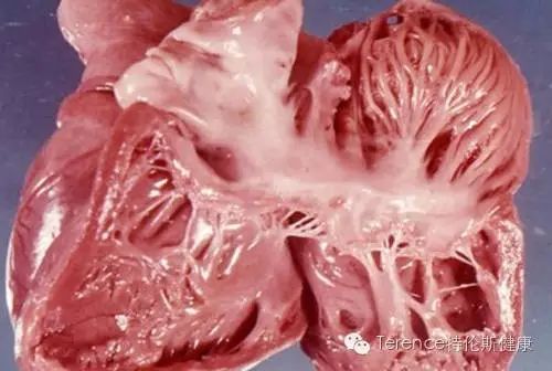 中年人每天补硒多少毫克（补硒对中老年人的好处）-硒宝网