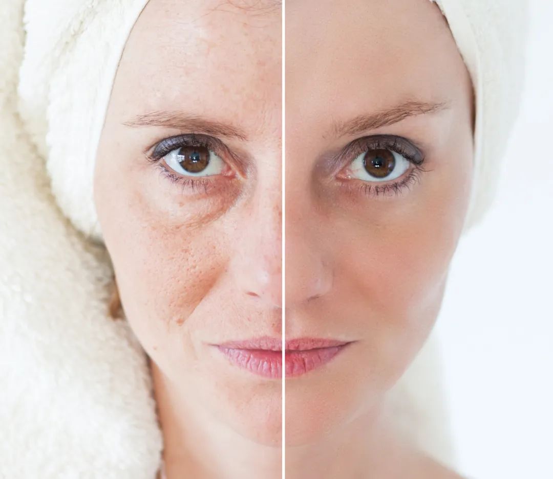 心脑血管疾病需要补硒吗（硒与心脑血管病）-硒宝网