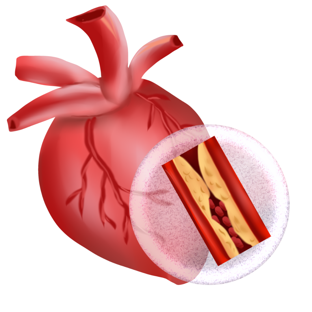 心脑血管疾病需要补硒吗（硒与心脑血管病）-硒宝网