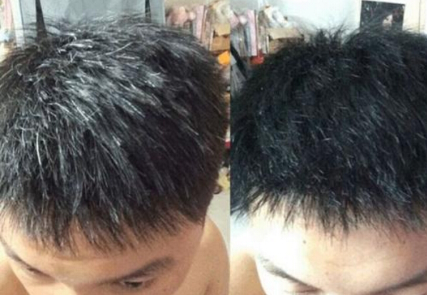 钙铁锌硒不缺能补吗女性(女人缺钙铁锌会有什么症状)-硒宝网