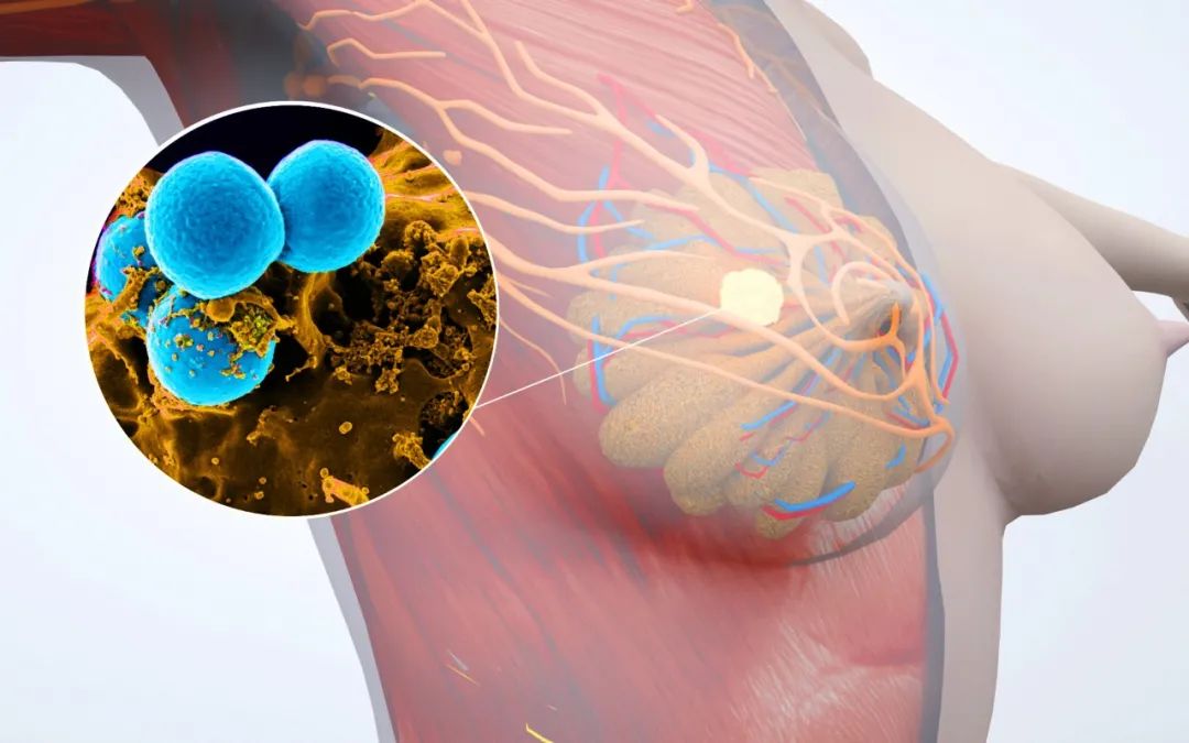 癌症患者每天补硒多少钱(癌症每天补患者钱硒多少)-硒宝网
