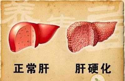 肝硬化能补硒元素吗女性(肝硬化能补硒吗)-硒宝网