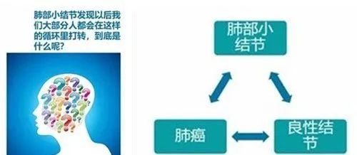 肺部有有结节可以补硒吗（肺结节可以吃硒酵母吗）-硒宝网
