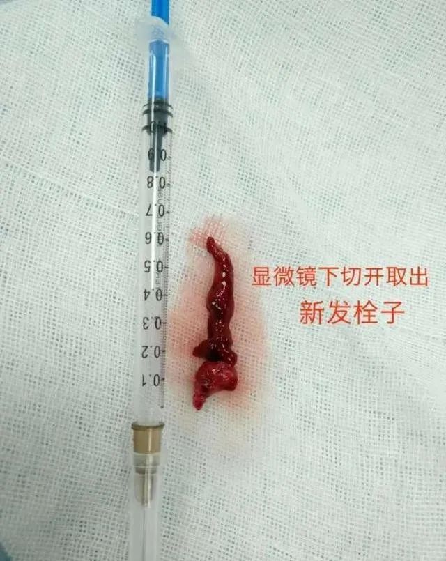 补硒有什么好处和副作用（硒对身体好处）-硒宝网