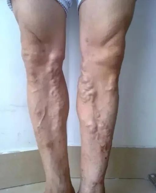 补硒有什么好处和副作用（硒对身体好处）-硒宝网