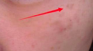 60岁女人补钙吃哪牌子(女士补钙吃哪种商品比较好)-硒宝网