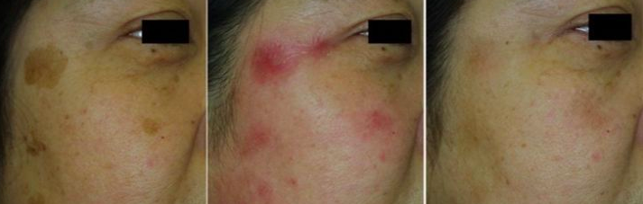 60岁女人补钙吃哪牌子(女士补钙吃哪种商品比较好)-硒宝网