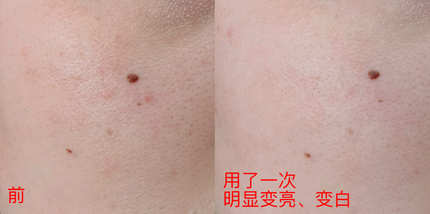 60岁女人补钙吃哪牌子(女士补钙吃哪种商品比较好)-硒宝网