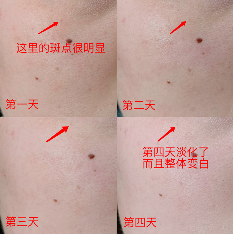 60岁女人补钙吃哪牌子(女士补钙吃哪种商品比较好)-硒宝网