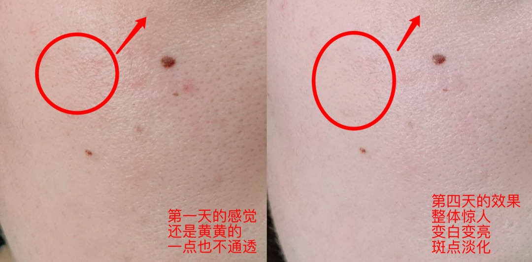 60岁女人补钙吃哪牌子(女士补钙吃哪种商品比较好)-硒宝网