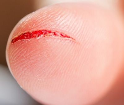 锌硒宝补多了有什么反应(锌硒宝不良反应)-硒宝网