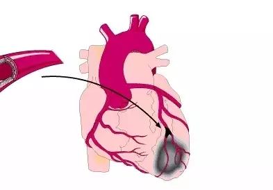 补硒对预防眼睛有好处吗(硒对眼睛的重要性)-硒宝网