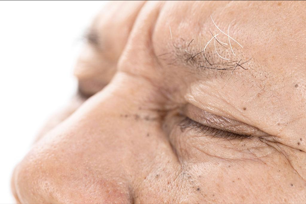 怎么知道是不是要补硒了（补硒很重要吗）-硒宝网