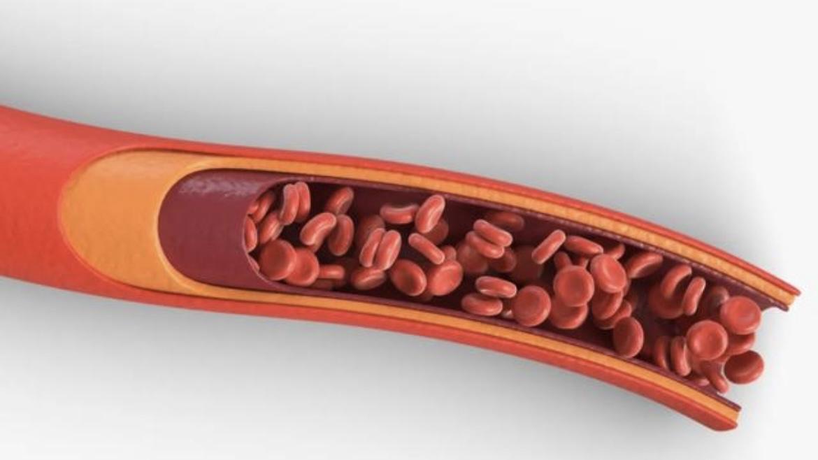 人可以同时补铁和补硒吗(补硒和补铁冲突吗)-硒宝网