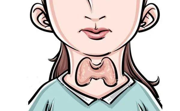 桥本氏甲减需要补哪种硒（桥本氏甲减需要补硒吗）-硒宝网