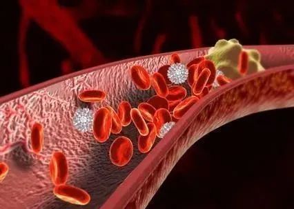 脑梗的人补硒有什么好处(硒与脑梗塞的关系是什么)-硒宝网