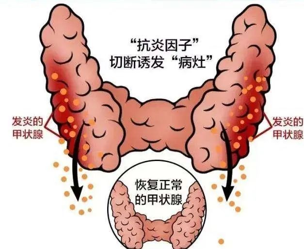 治疗甲状腺癌可以补硒吗(甲状腺癌症可以吃硒片吗)-硒宝网