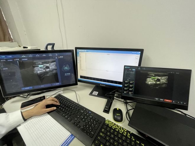 甲状腺结节补硒三类食物(甲状腺结节补硒有什好处)-硒宝网