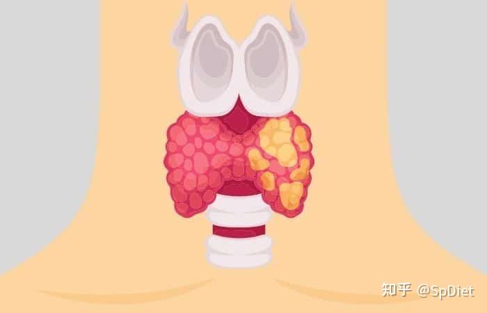 桥本甲状腺炎是不是补硒（桥本甲状腺炎硒）-硒宝网