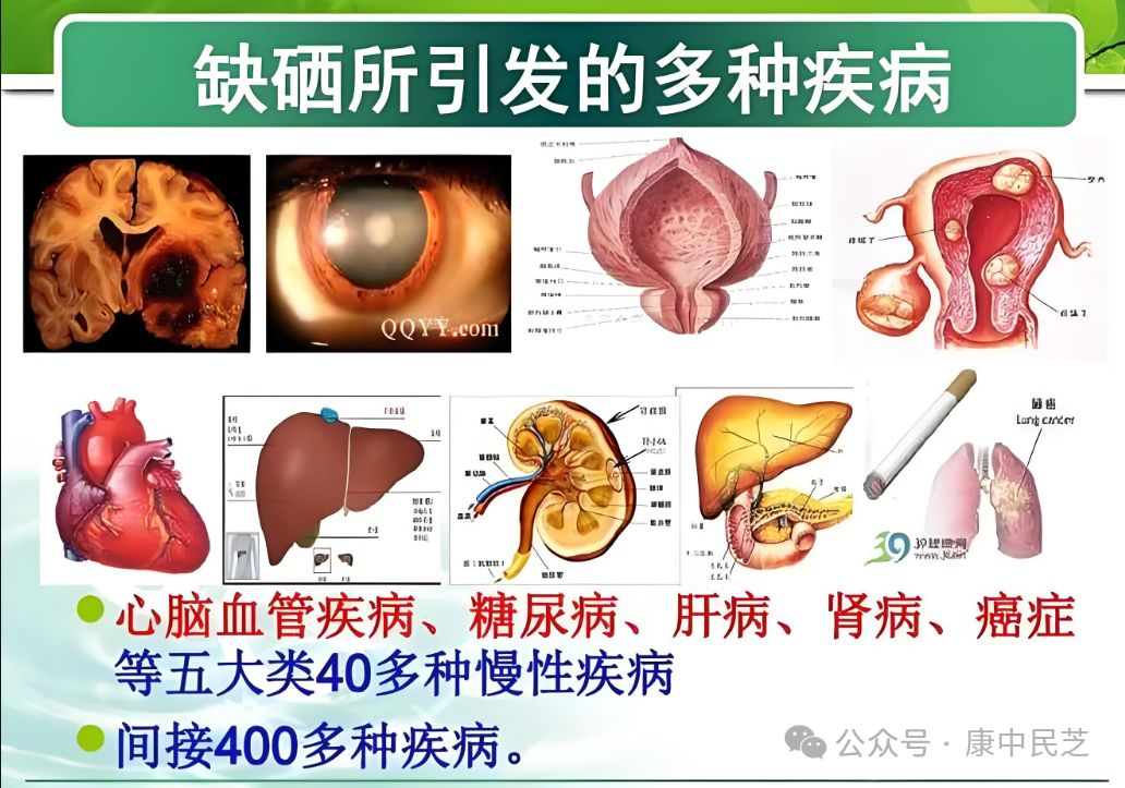 糖尿病了可以长期补硒吗（糖尿病患者可以补硒吗）-硒宝网