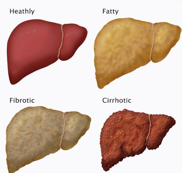补硒会不会口干口苦口臭（会补口臭口干口苦硒含量高吗）-硒宝网