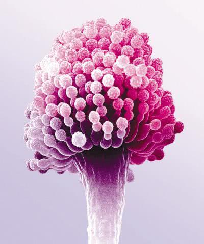 补硒会不会口干口苦口臭（会补口臭口干口苦硒含量高吗）-硒宝网