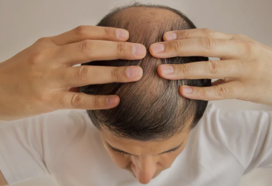 身上缺硒吃什么食物能补(缺硒吃什么保健品)-硒宝网