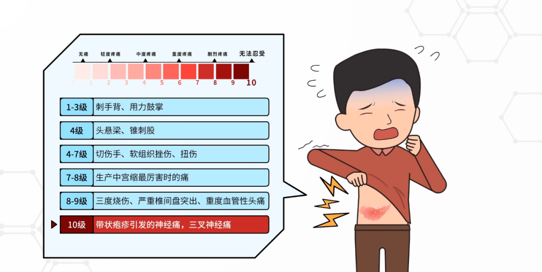 得过带状疱疹需要补硒吗（带状疱疹需要补维生素吗）-硒宝网