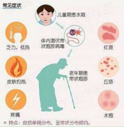 得过带状疱疹需要补硒吗（带状疱疹要补充维生素吗）-硒宝网