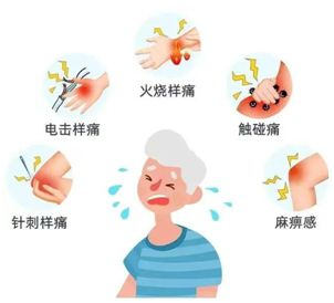 得过带状疱疹需要补硒吗（带状疱疹要补充维生素吗）-硒宝网