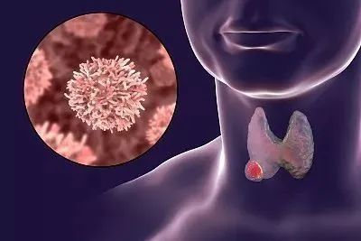 甲状腺癌可以补硒嘛女性(甲状腺癌能吃硒酵母吗)-硒宝网